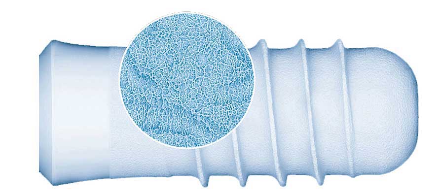 Dental implant surface