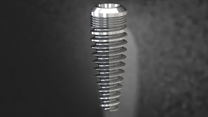 Sandblasting dental implants Sandblasting dental implants